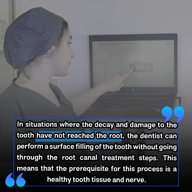 5 Risks of Filling a Tooth Without a Root Canal