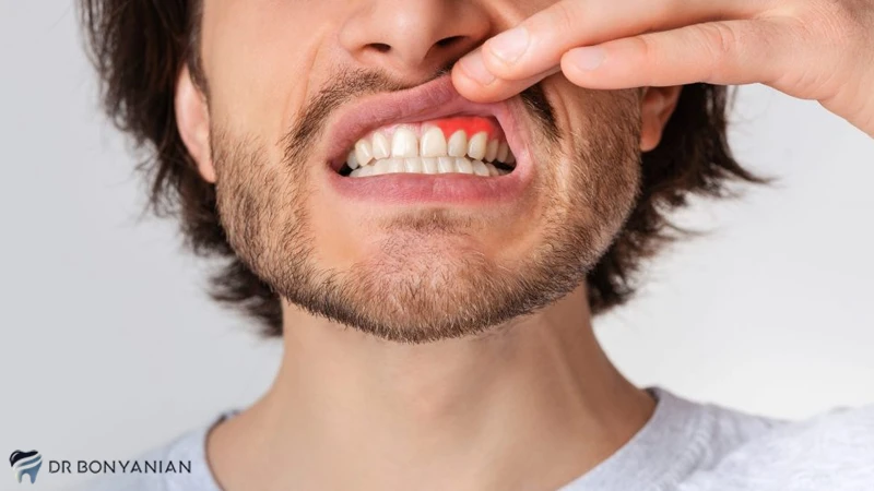 پیشگیری از آبسه دندان
