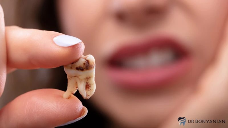 چگونه پوسیدگی دندان را از بین ببریم