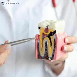 تقویت مینای دندان با ۱۲ راهکار کاربردی