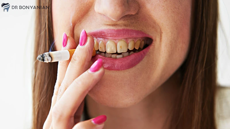 استعمال دخانیات و عفونت ایمپلنت دندان