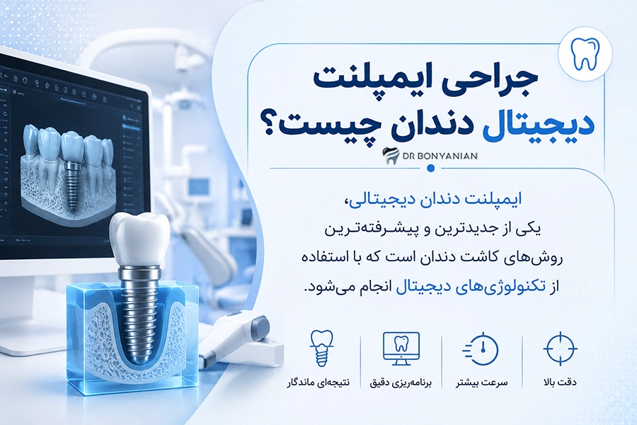 جراحی ایمپلنت دیجیتال چگونه انجام می&zwnj;شود؟
