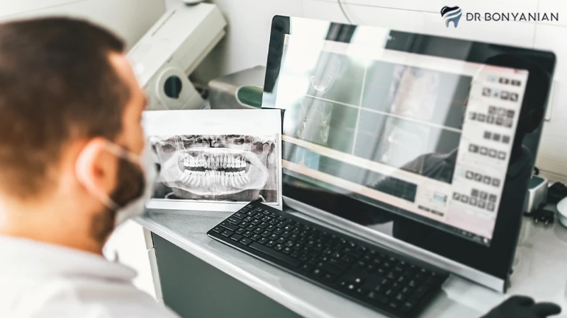 ایمپلنت دندان دیجیتال در کلینیک دکتر بنیانیان
