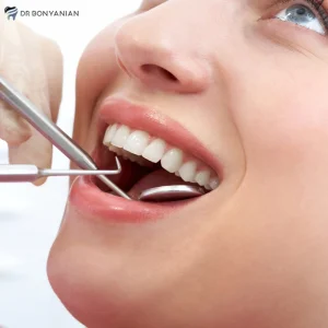 انواع کامپوزیت دندان و کاربردهای آن