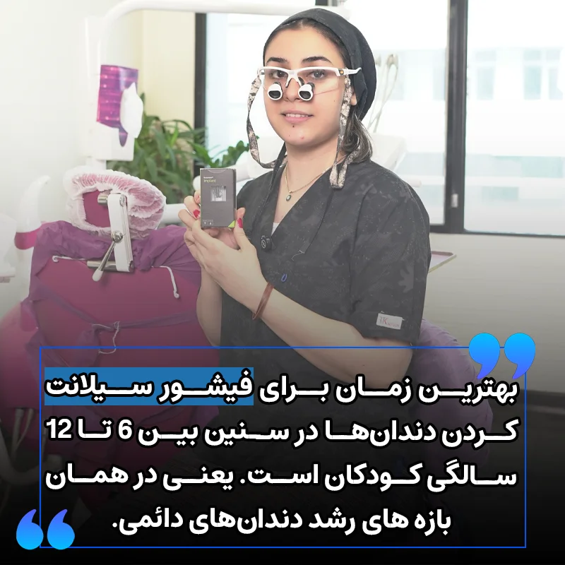 بهترین زمان برای فیشورسیلانت کردن دندان کودکان