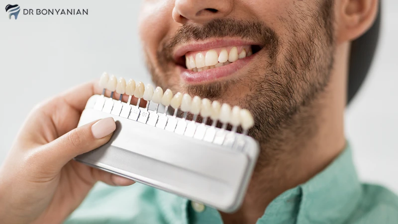 عوارض لومینیرز