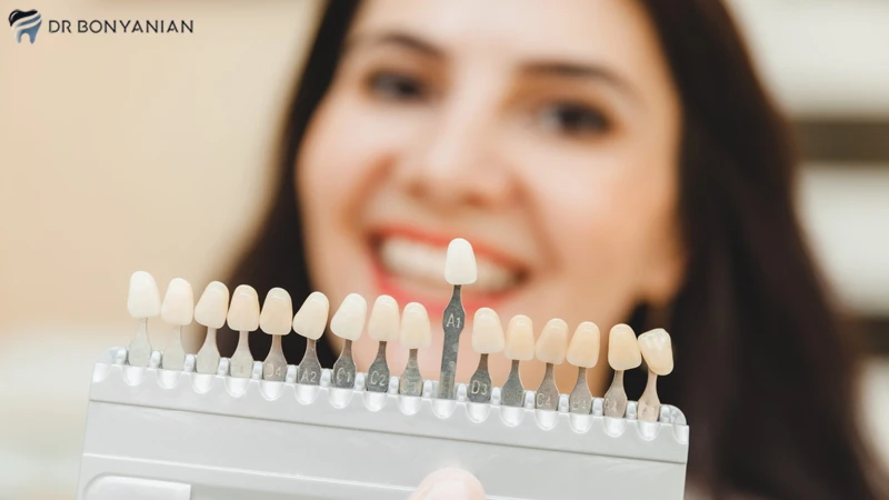 ماندگاری لمینت دندان لومینیرز