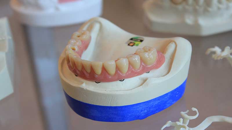 وقتی دندان دائمی از فک بیرون بیفتد چه باید کرد؟