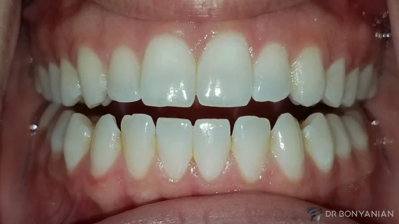 اپن بایت اسکلتی