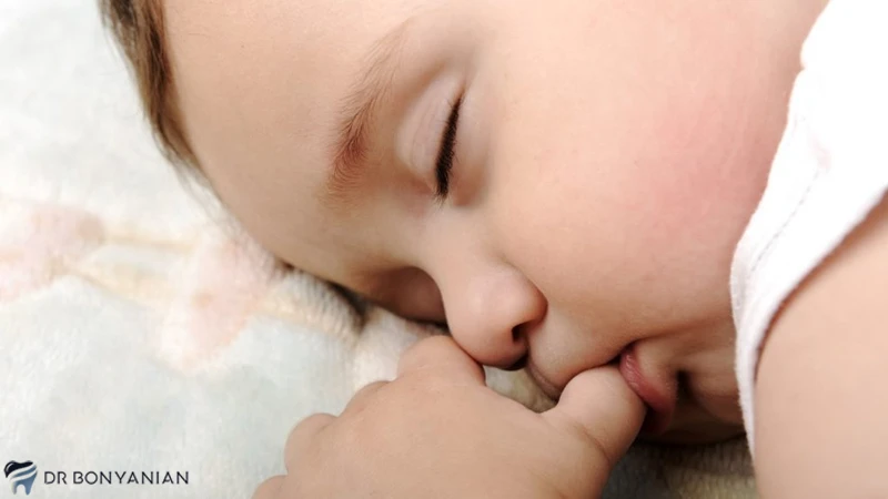 درمان اپن بایت