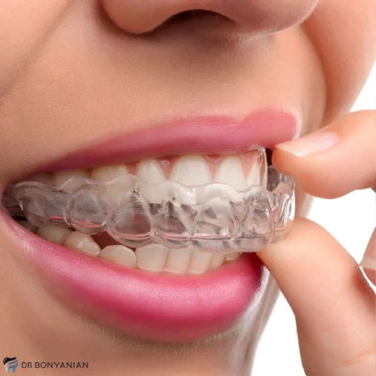 ناهنجاری اپن بایت چیست؛ علل ایجاد و درمان آن