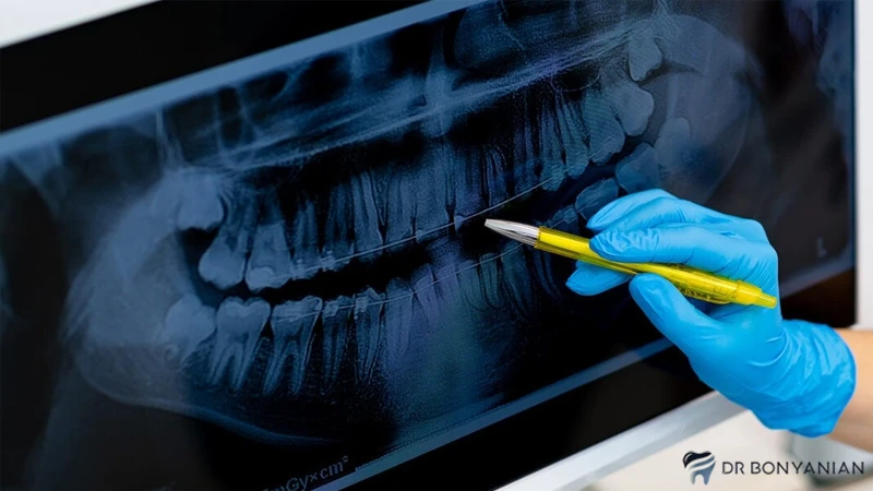 Who is a good and cheap dentist in Tehran?