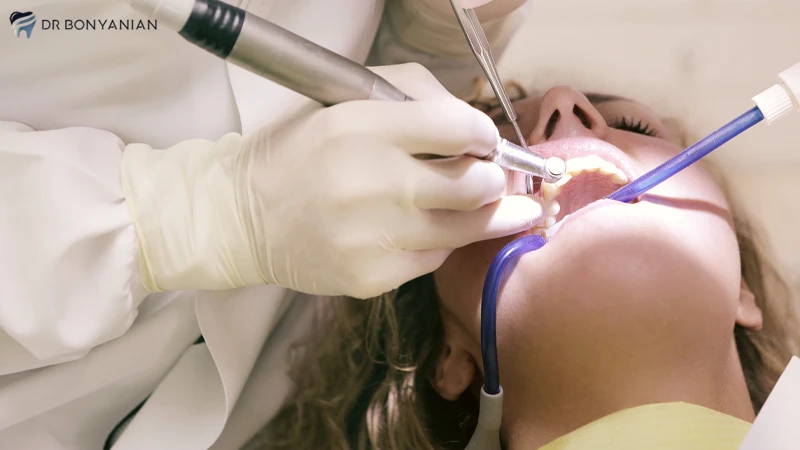 مراحل ایمپلنت دندان چقدر طول می کشد