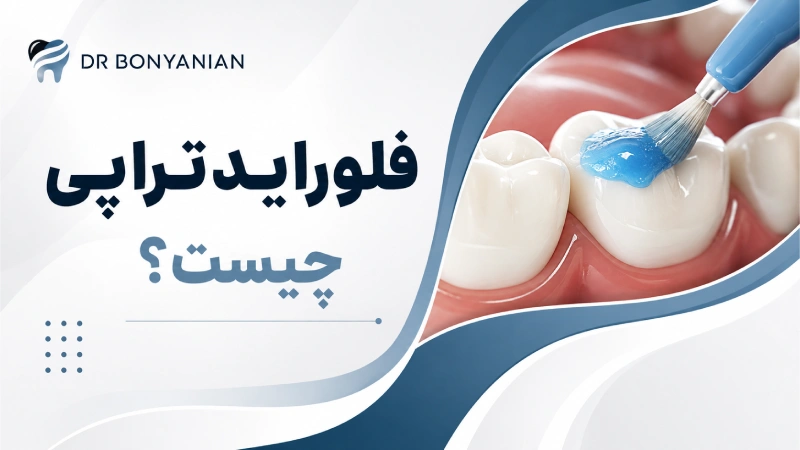 فلورایدتراپی چیست؟