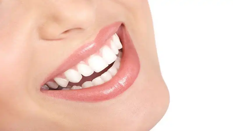 مزایای پروتز ثابت دندان