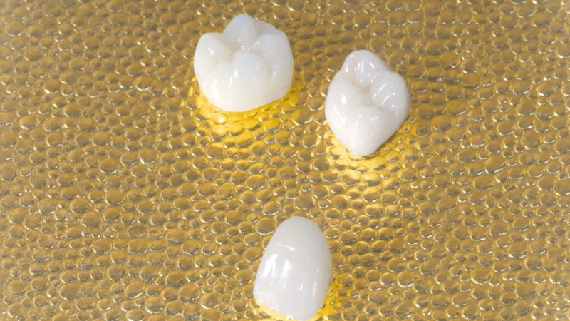 استفاده از پست و کور در بازسازی تاج دندان