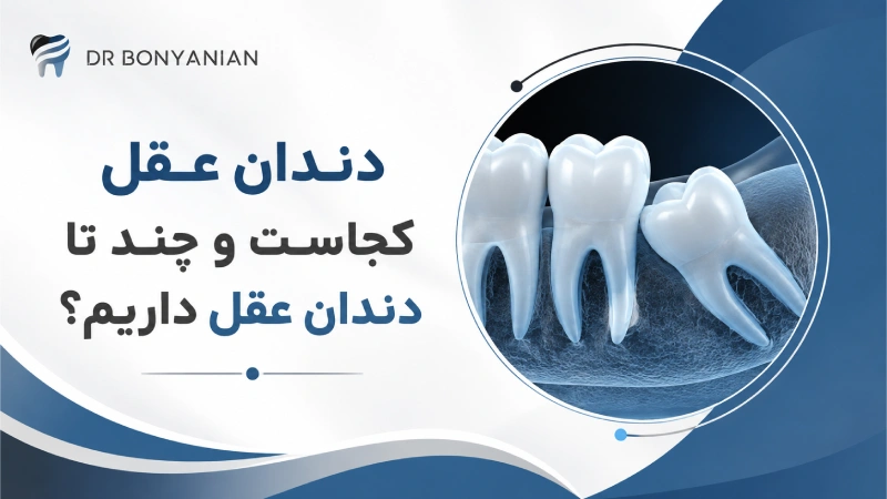 دندان عقل کجاست و چند تا دندان عقل داریم؟