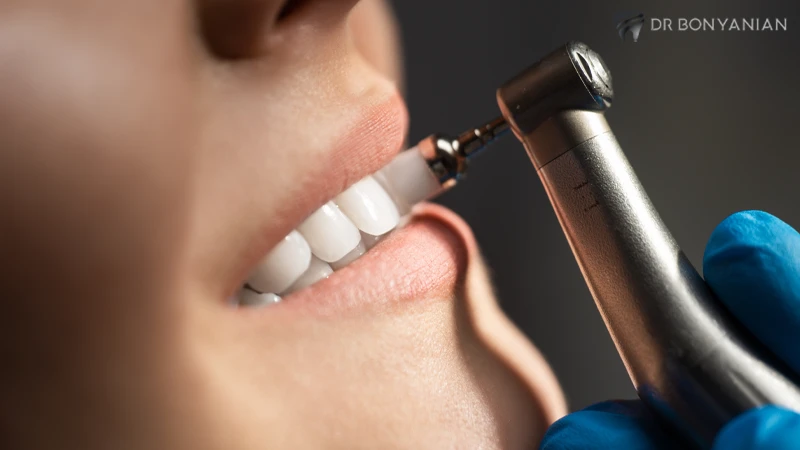 پیشگیری از تشکیل جرم دندان