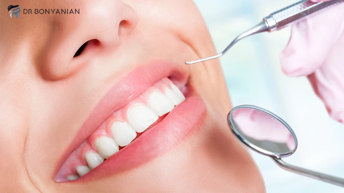 جراحی لیفت لثه