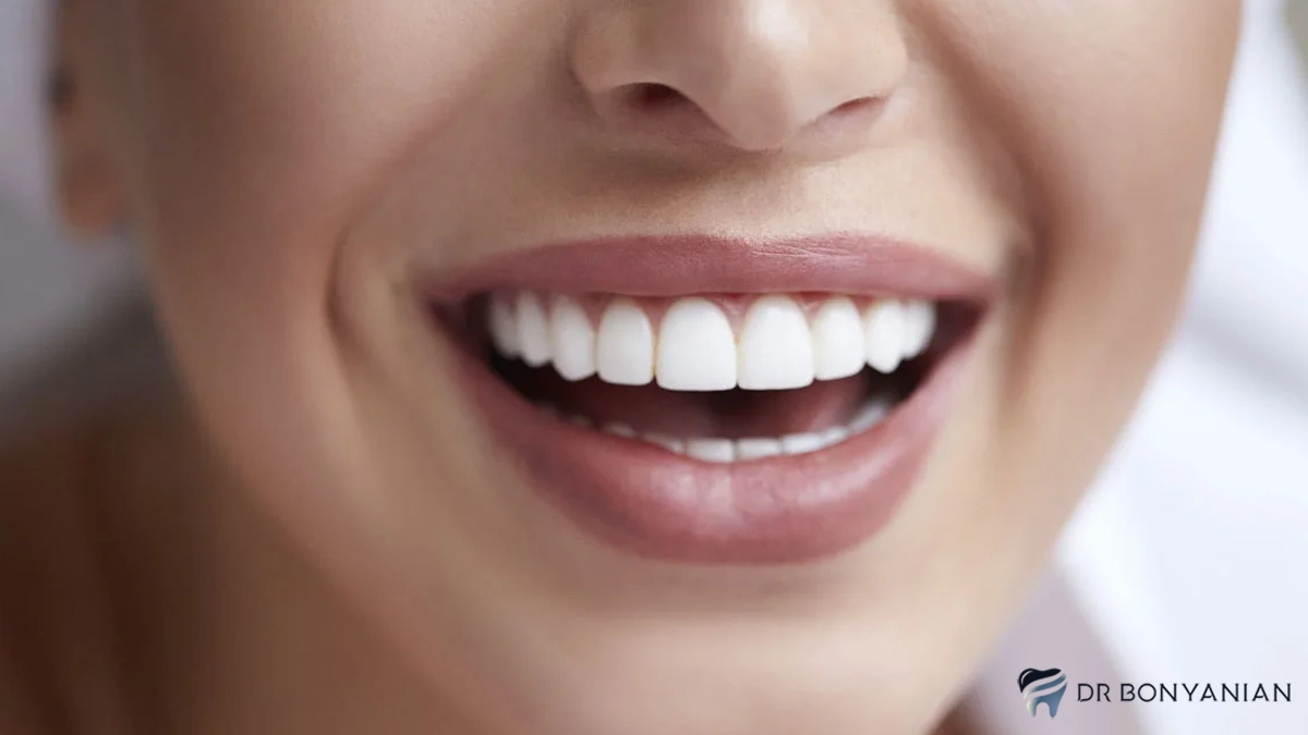 هزینه جراحی لثه