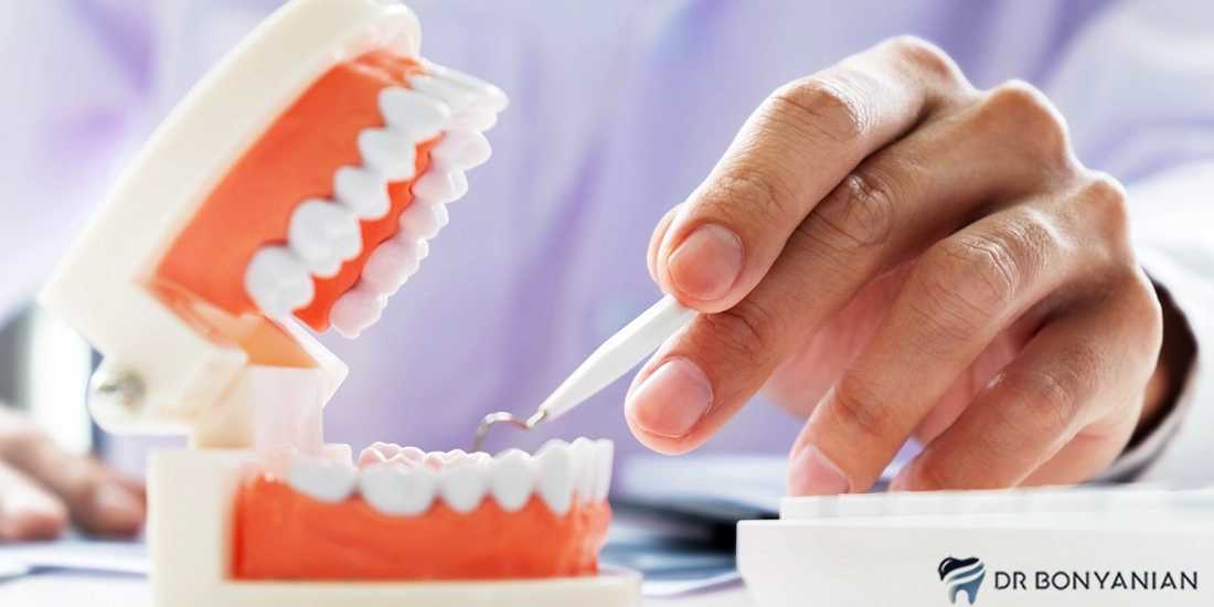 انواع مواد پر کردن دندان