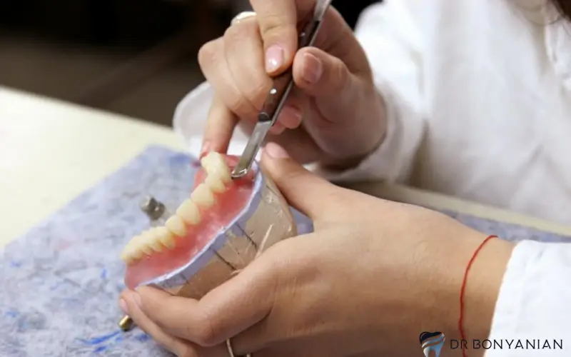 روش آماده سازی پروتز دندانی