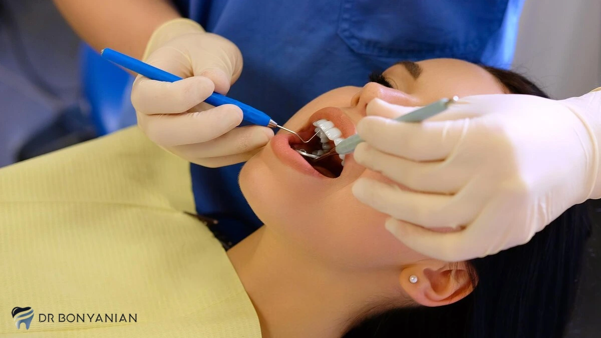 روش های جایگزین کامپوزیت دندان