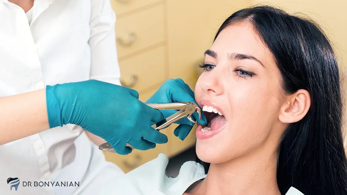 روش های کشیدن دندان