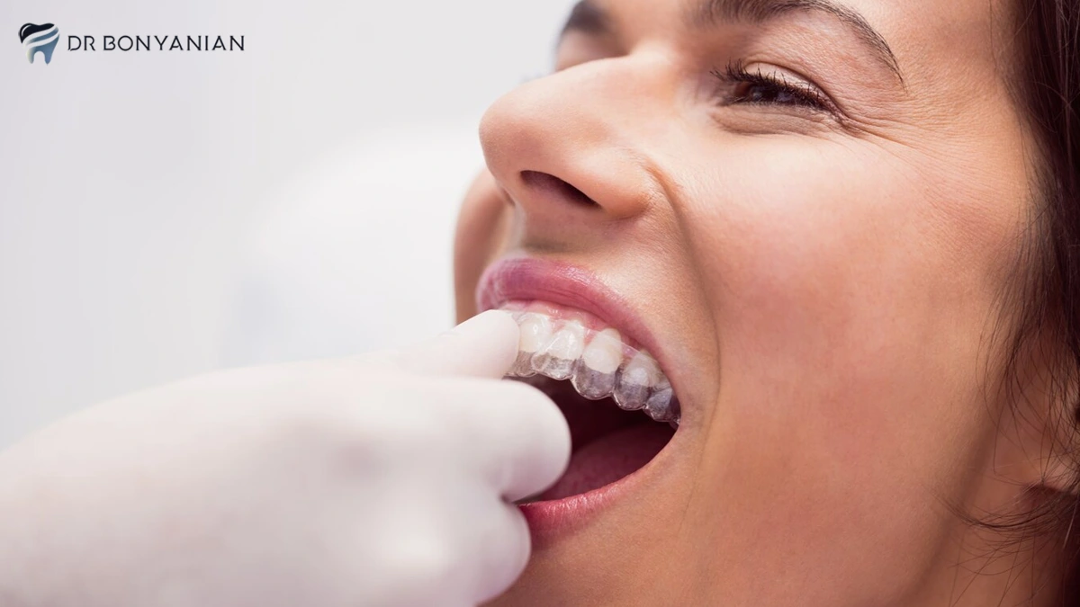 کامپوزیت دندان در کلینیک دندانپزشکی دکتر بنیانیان