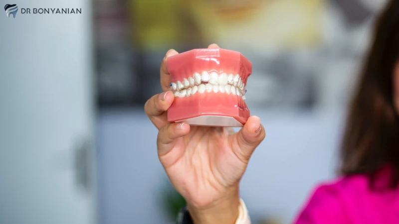 تفاوت در جنس ایمپلنت های مختلف از علل تفاوت قیمت ایمپلنت دندان