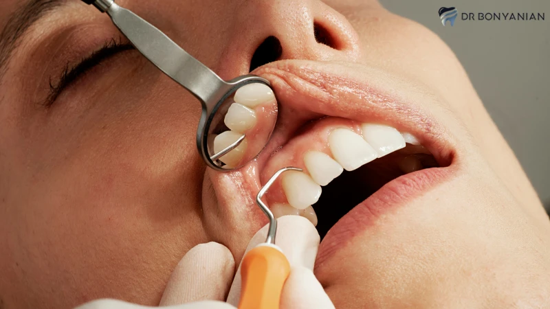عوامل تاثیرگذار بر قیمت ایمپلنت دندان