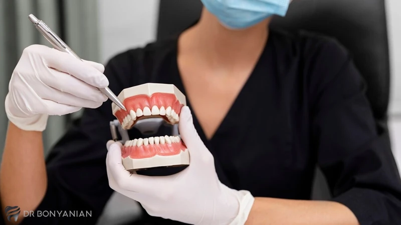 انواع روش های ایمپلنت دندان