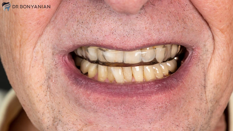 منظور از رعایت ترتیب خدمات دندانپزشکی چیست؟
