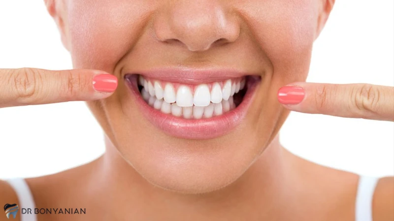 عوامل موثر بر ماندگاری لمینت دندان