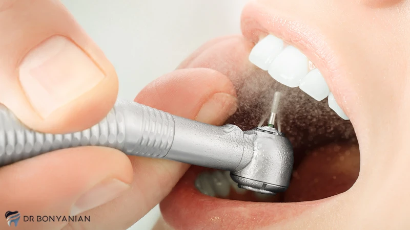 عصب کشی و ترمیم دندان از اولویت بندی خدمات دندان پزشکی