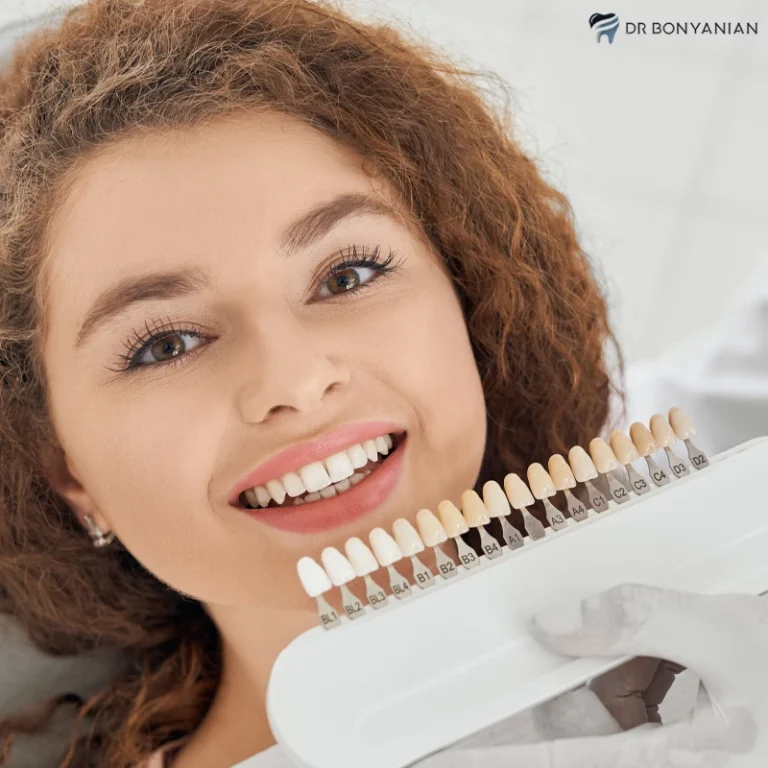 تراشیدن دندان برای نصب لمینت