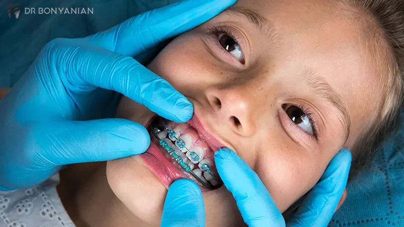 ارتودنسی دندان کودکان چیست؟