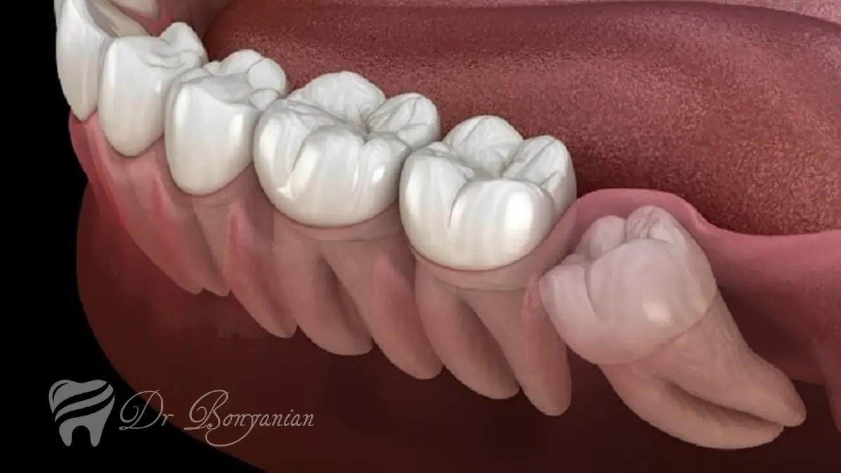 هزینه جراحی دندان-دندانپزشکی دکتر بنیانیان