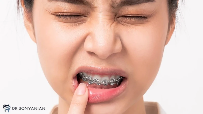 اعمال فشار به دندان در ارتودنسی