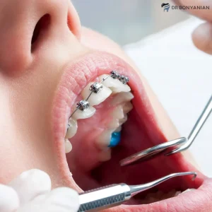 آیا ارتودنسی دندان درد دارد؟