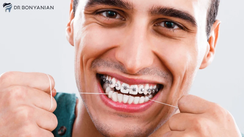 نحوه استفاده از نخ دندان برای مراقبت ارتودنسی 