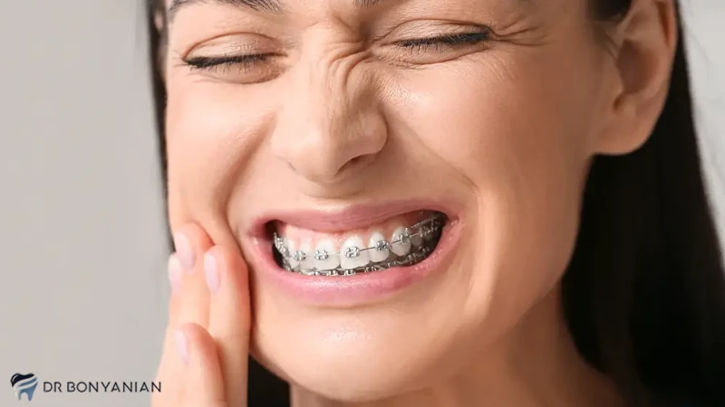 دلیل درد ارتودنسی دندان 