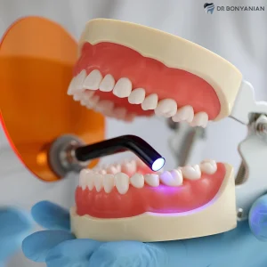 مراقبت‌های پیش از جراحی ایمپلنت دندان