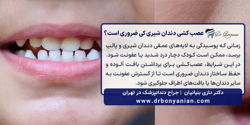 عصب ‌کشی دندان شیری برای کودکان چه زمانی ضروری است؟