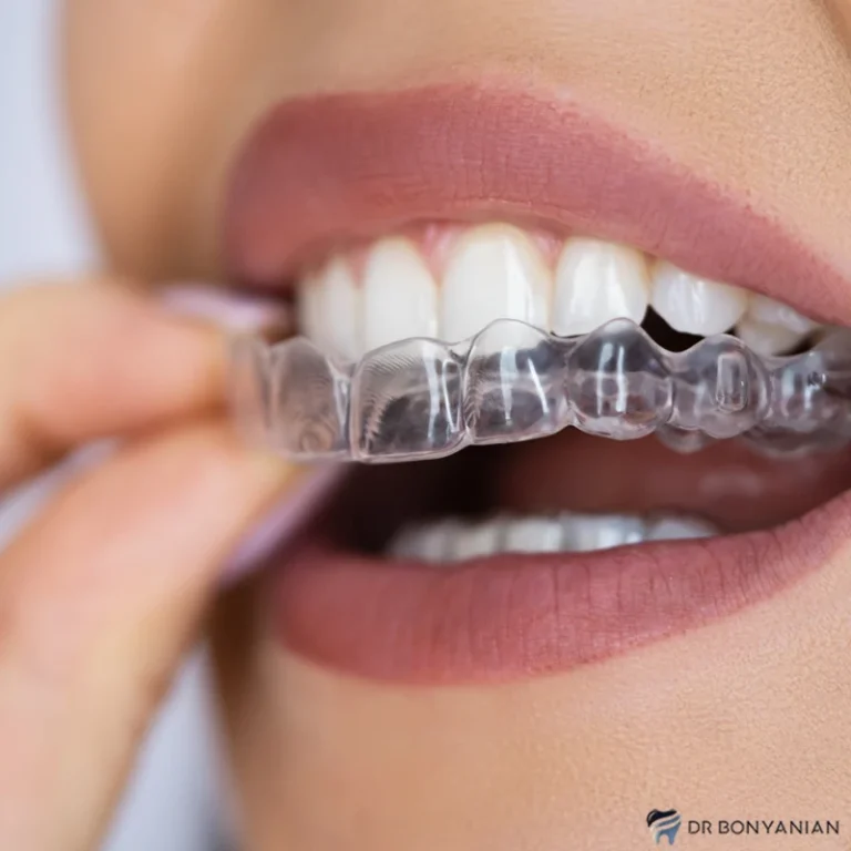 نایت گارد چیست و چگونه می‌توانیم از آن استفاده کنیم؟