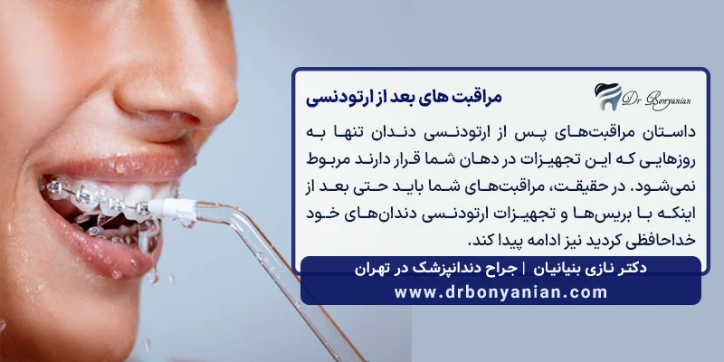 مراقبت های بعد از ارتودنسی