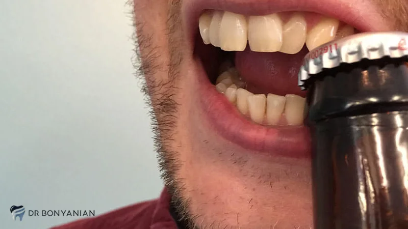 فشار زیادی به دندان مورد نظر وارد نکنید