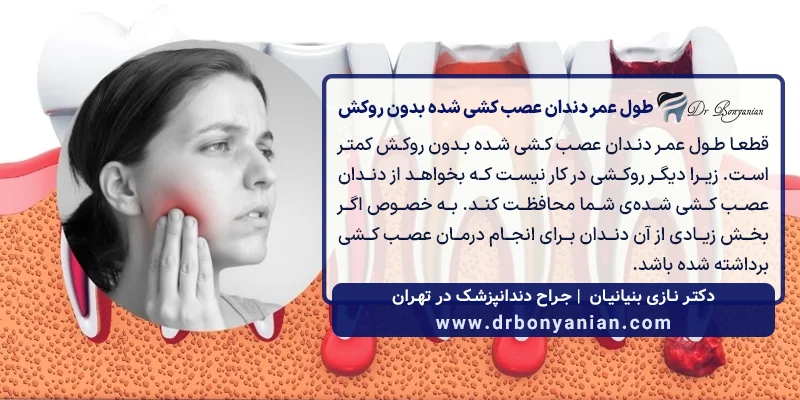 طول عمر دندان عصب کشی شده بدون روکش