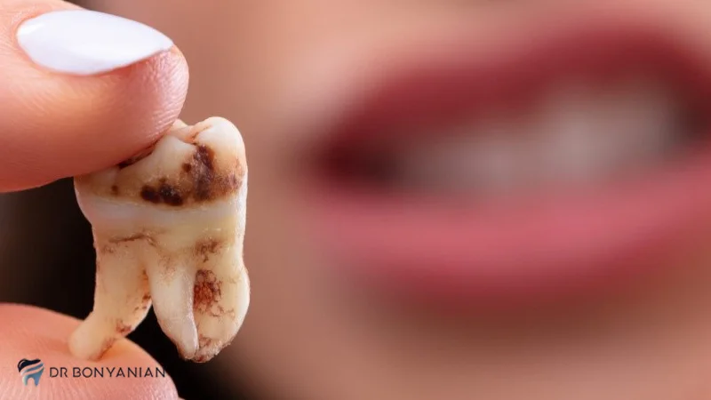 آسیبهای جانبی و بعدی به دندان