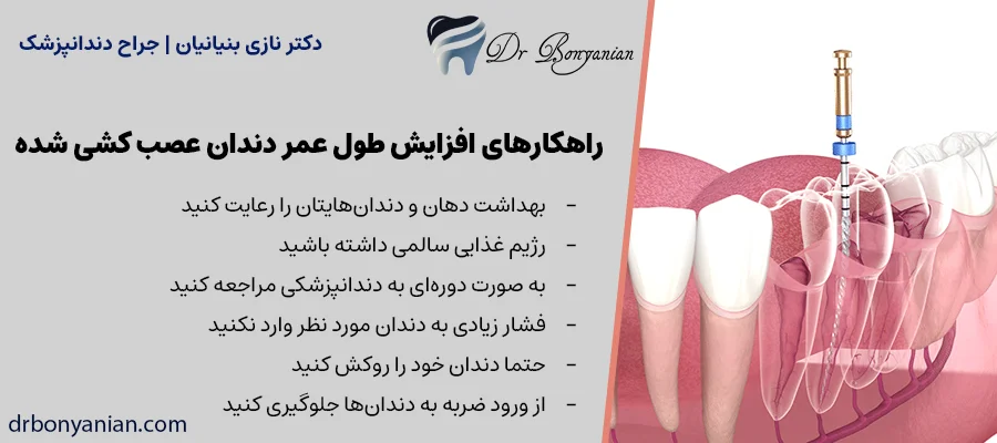 راهکارهای افزایش طول عمر دندان عصب کشی شده
